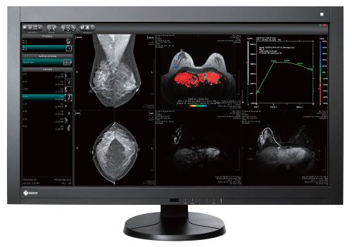 EIZO RadiForce RX440 29.8寸 使用时间18544Hメディカルwatch » Blog