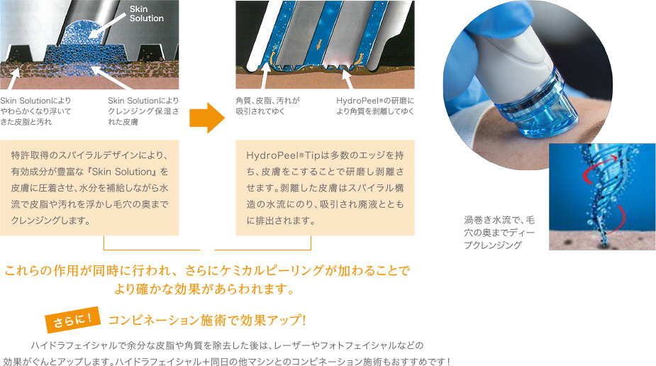 正規品！ハイドラフェイシャル保険加入水素角質毛穴必須メニュー