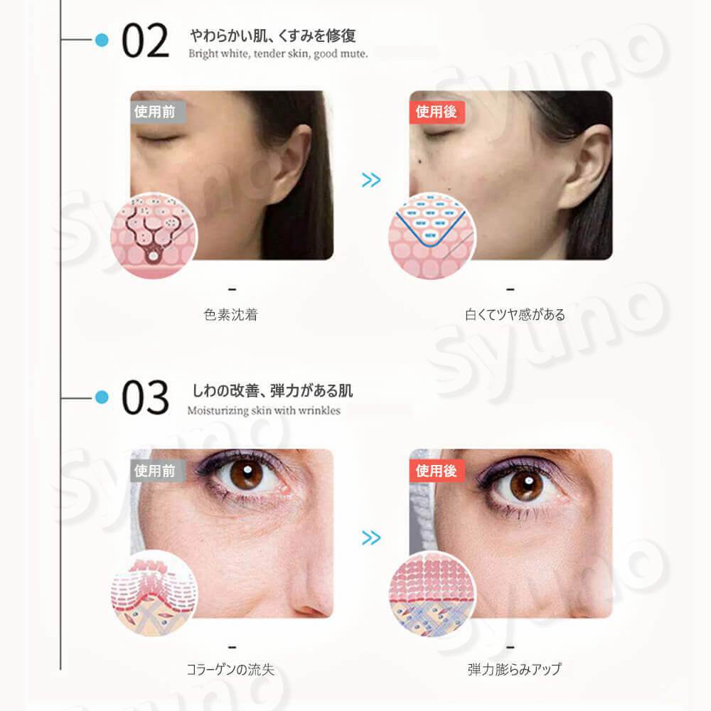 楽天市場】お買い物マラソン【P5倍】LED美顔マスク 多機能美顔器 美顔