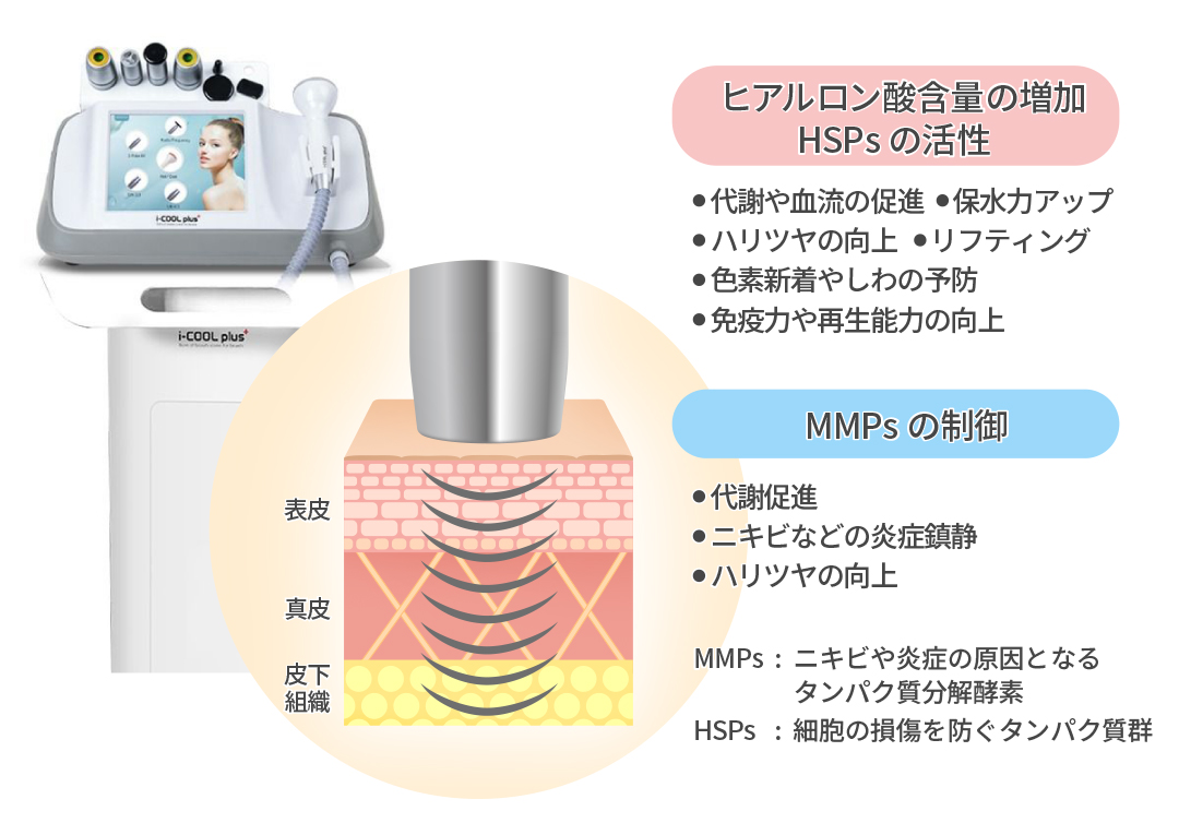 水玉リフティング LDM SONOと同等マシン 韓国肌管理(更にRF機能も付き 水玉