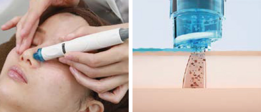 medi aquapro - 株式会社ドクターセレクト Dr.Select