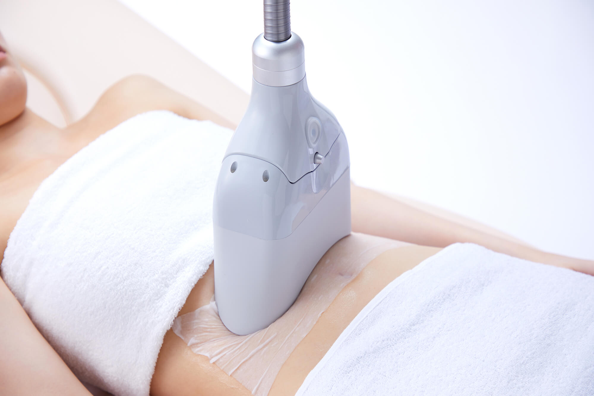 脂肪冷却、クールスカルプティングマシン