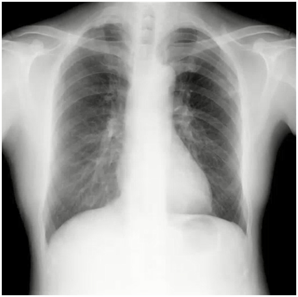 第4回 X線動態画像セミナー（WEB配信） - ヘルスケア | コニカミノルタ