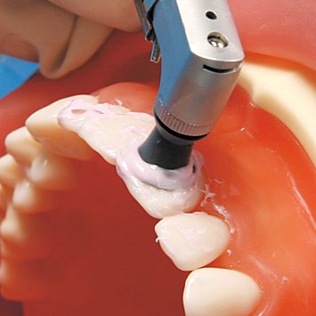 シンプルマネキンⅢ｜株式会社ニッシン｜歯科模型・歯科材料のトップ