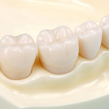 SRP用顎模型 [D18D-500H(GUB)-MF](D咬合器つき)｜株式会社ニッシン