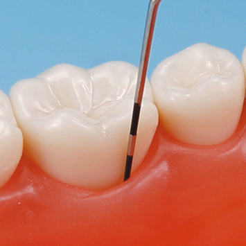 SRP用顎模型 [D18HD-500H(GUB)-MF](咬合器なし)｜株式会社ニッシン