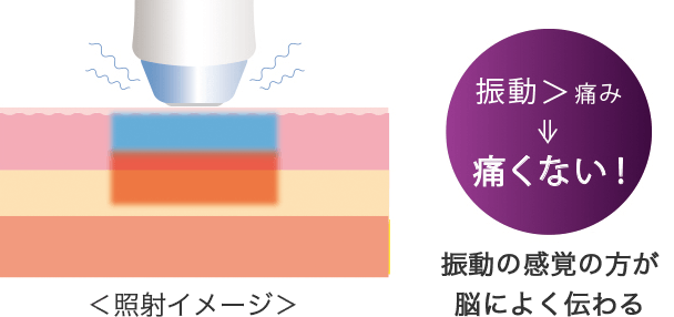 日本初導入「サーマクールFLX」！ご予約受付中！｜シロノクリニック