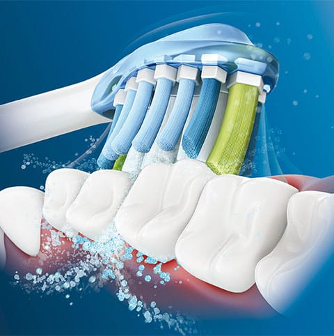 ソニッケアー史上最高*のブラッシング体験をあなたに「ソニッケアー