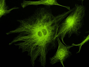 倒立型蛍光顕微鏡｜AXJ-5300TPHFL｜レイマー顕微鏡オンラインショップ