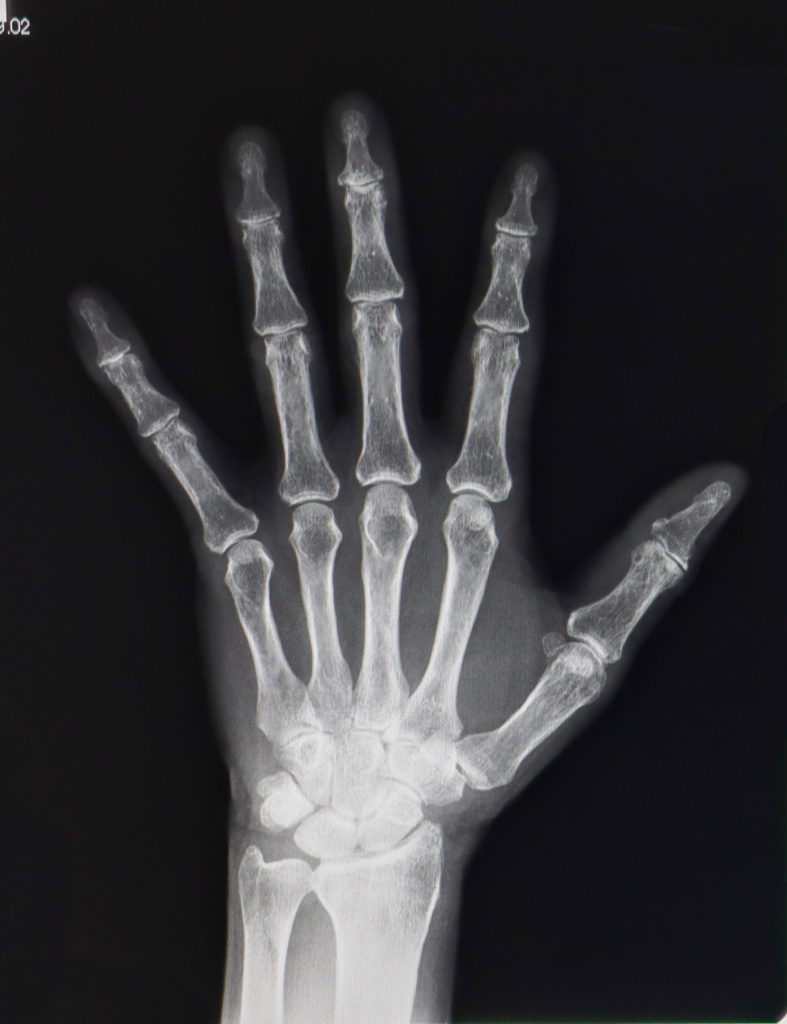 Vol.6］X線って何？ ｜ レントゲン写真の仕組み - 医療法人 横浜平成会