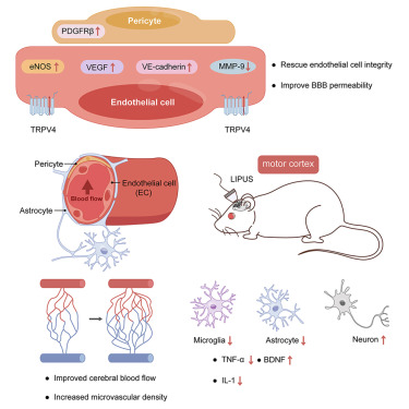Low-intensity pulsed ultrasound modulates disease progression in