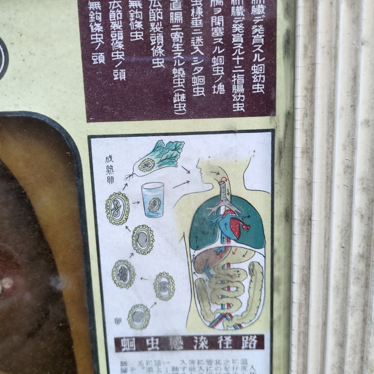 珍品、レトロ 医学模型 寄生虫 昭和マニアックレトロ内蔵模型レア内臓