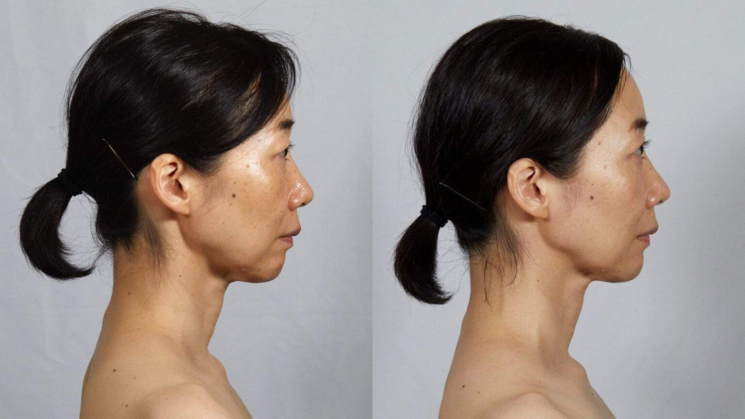 Face Player II – Bijo; Paris