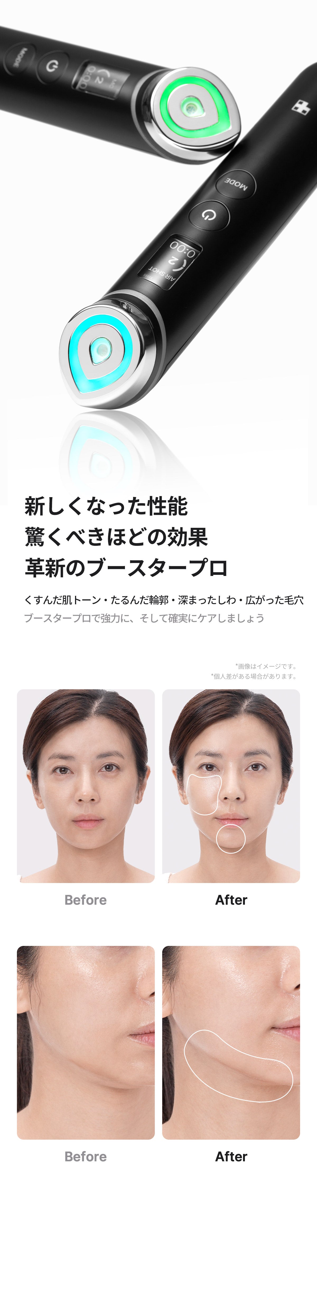 メディキューブ ブースタープロ AGE-R BOOSTER PRO 美顔器 小売業者