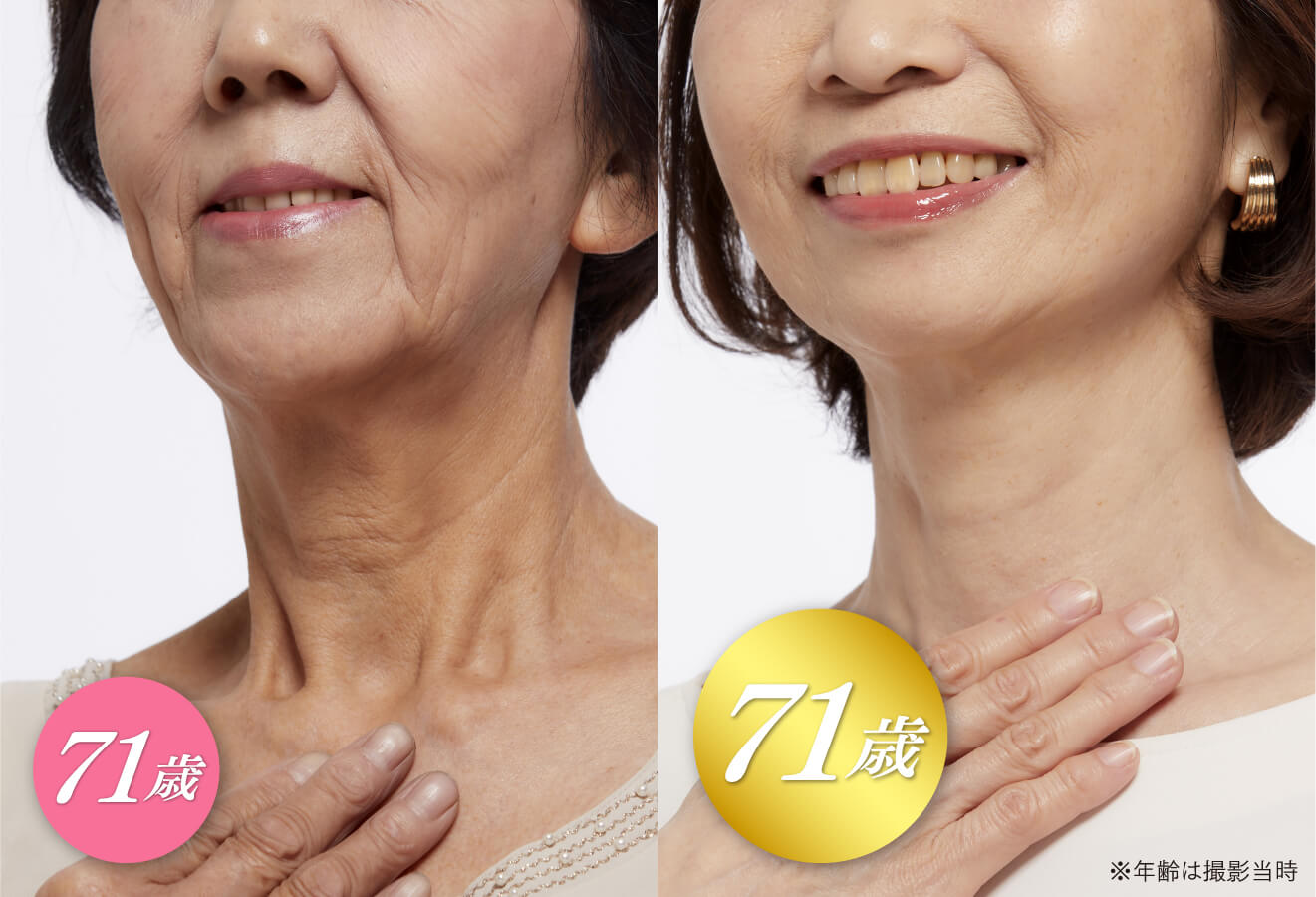 キミエリンクルホワイト2個 キミエリンクルホワイト｜富山常備薬