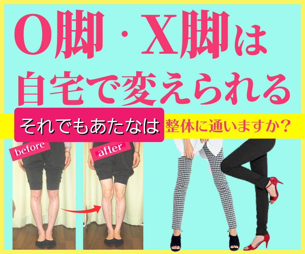 ストレグ ストレートレッグ O脚改善 美脚 脚痩せ ダイエット