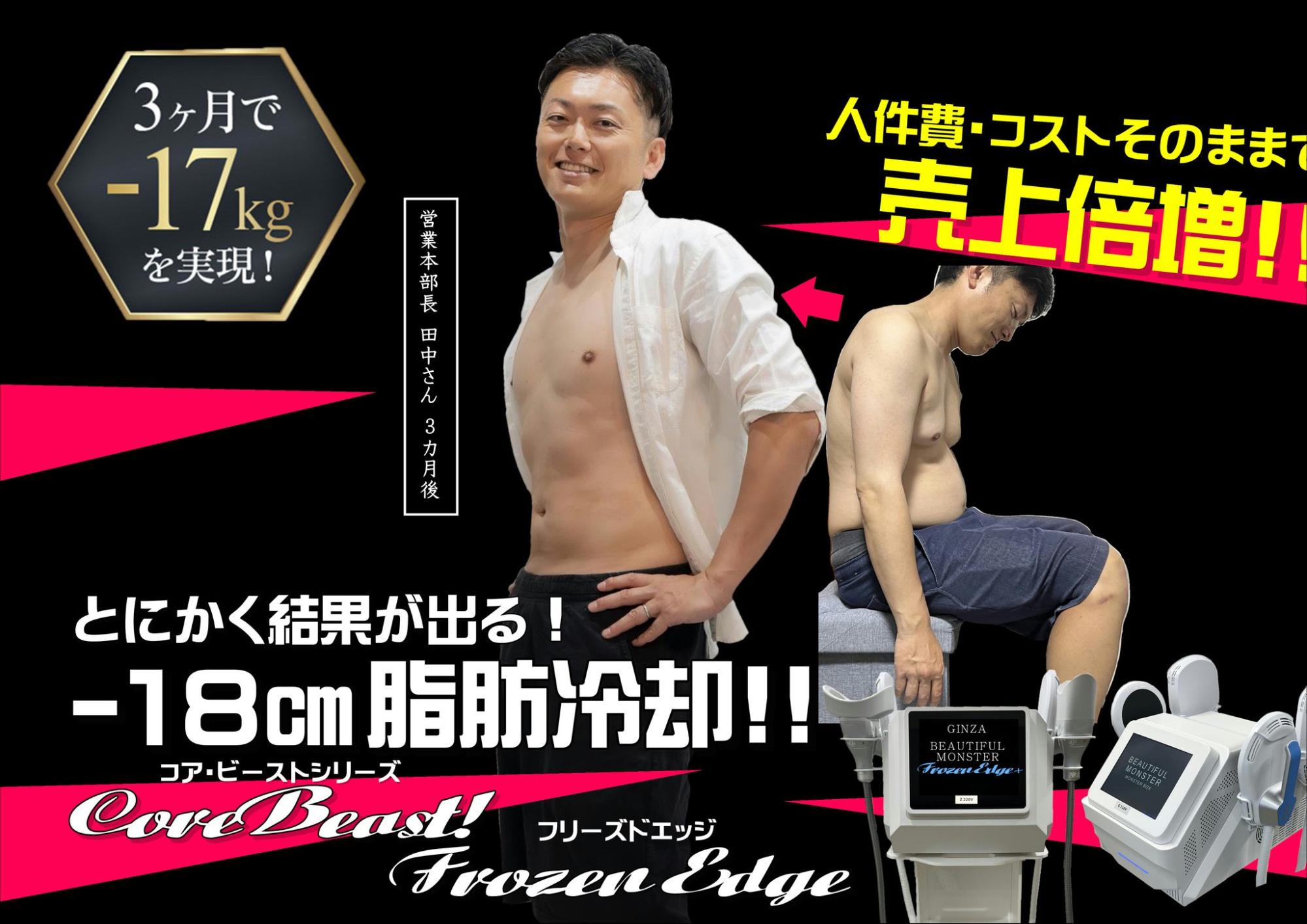 脂肪冷却痩身マシン｜フリーズドエッジの特徴・効果・価格について徹底
