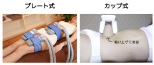 脂肪冷却カップ脂肪冷却マシン