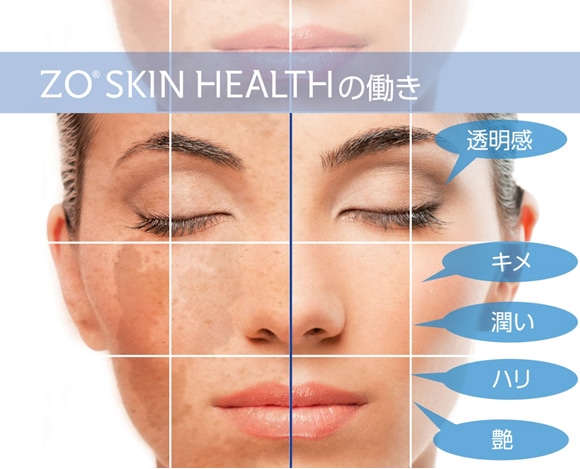 ゼオスキン 透明感 ミラミン新品未開封