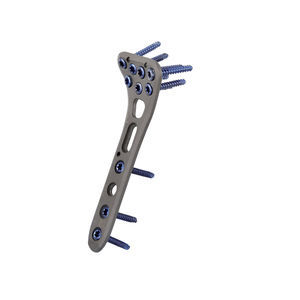 上腕骨用圧迫プレート - Vortex - Sanatmetal - 近位部 / ロッキング