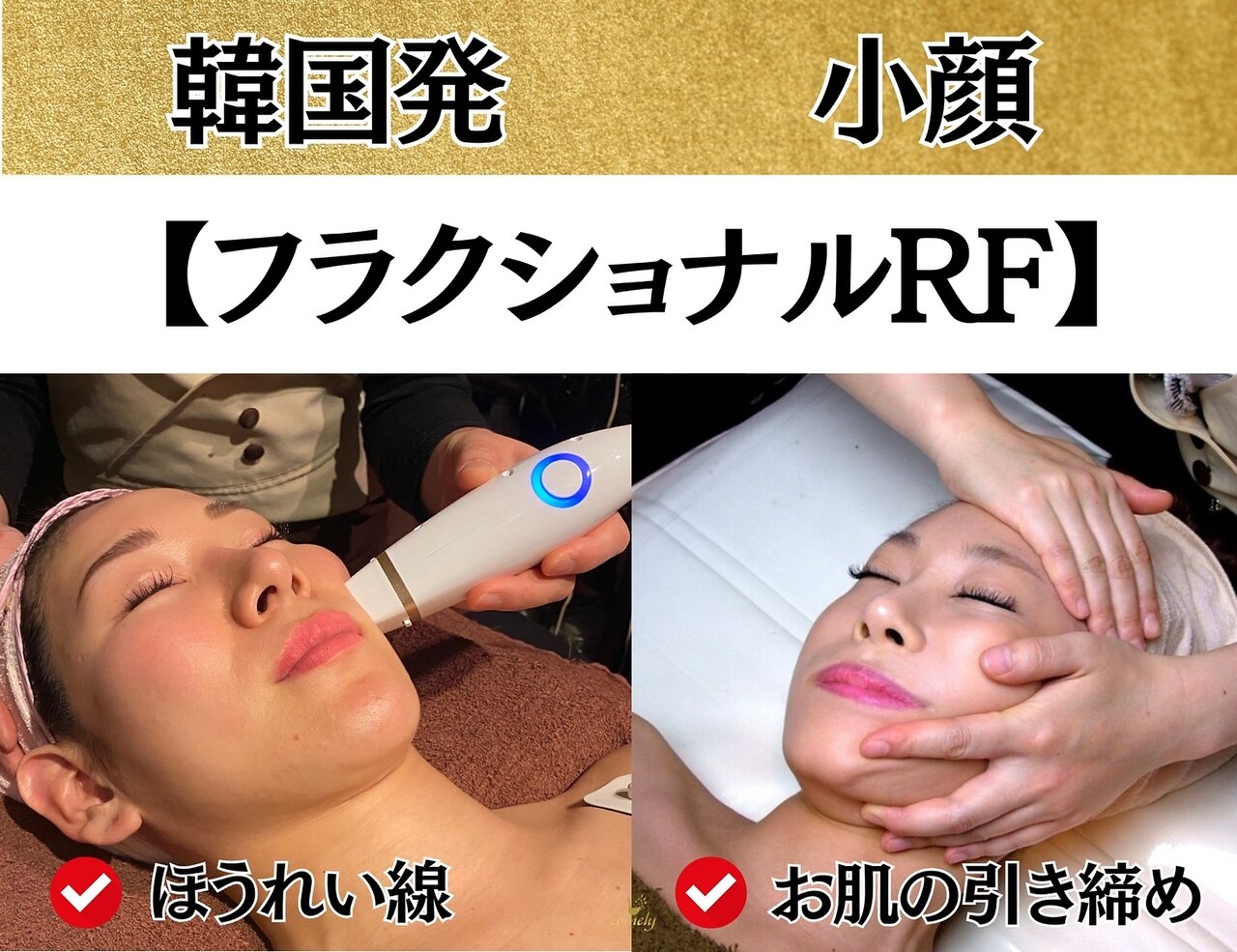 サーマルフラクショナル ☆ お顔の凸凹ケア リフトアップ に