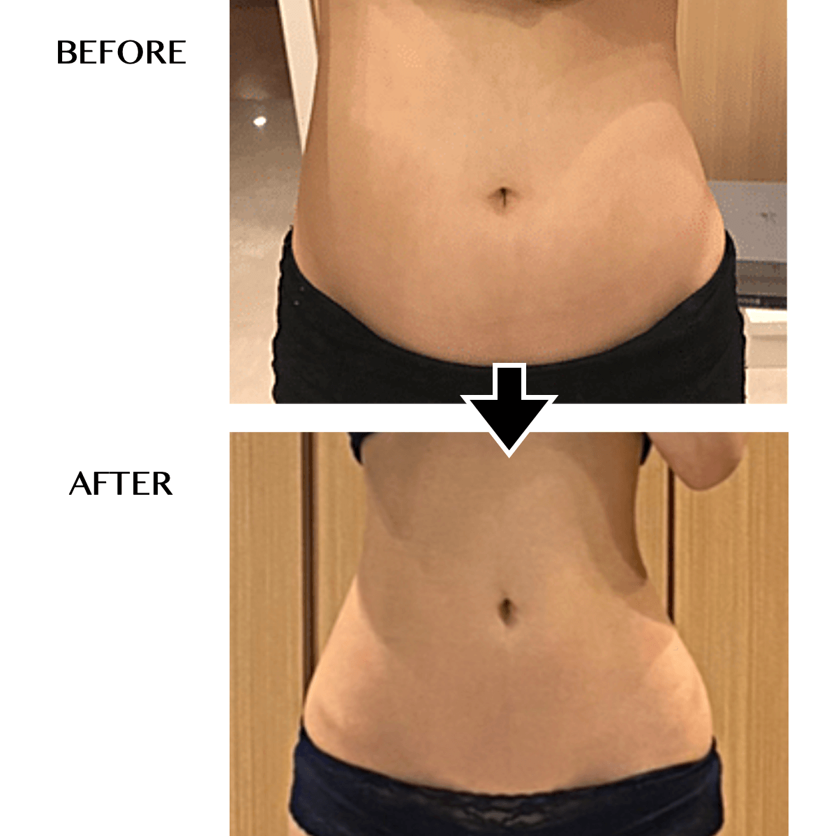 美品 じぶんdeエステ セルゼロマックス CELLZERO MAX | 「じぶんdeエステ」