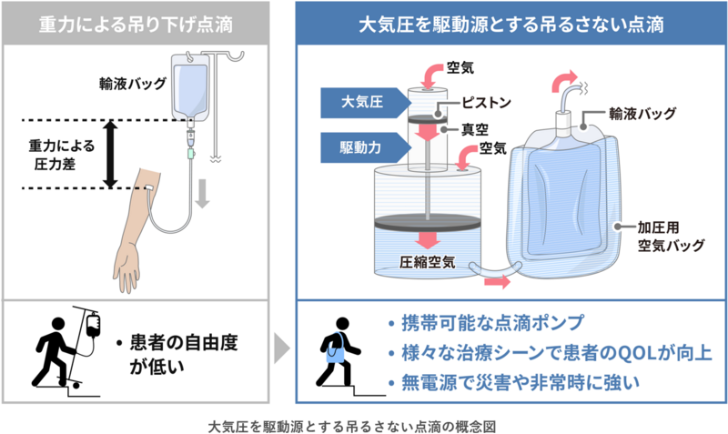 吊るさない点滴」が医療機器に | 産総研のプレスリリース | 共同通信PR