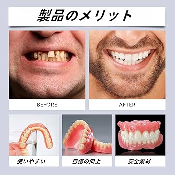 Amazon | シリコン入れ歯セット シリコン製 着脱簡単 美白対応 再利用