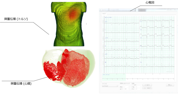 心臓の挙動を学習できる「Heart Explorer」を販売開始 : 富士通