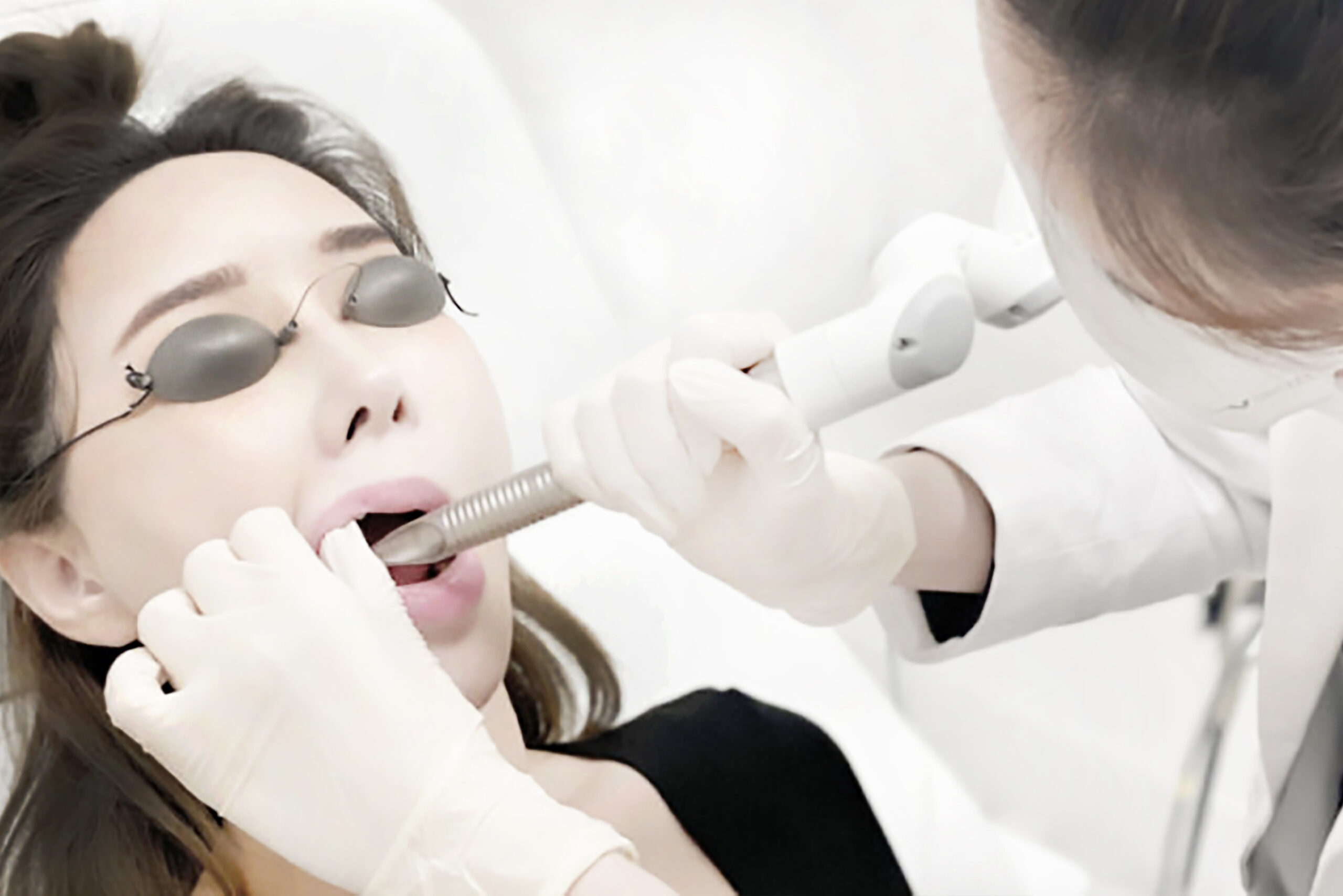 リフトアップレーザー - SSCビューティークリニック - Fotona4Dの