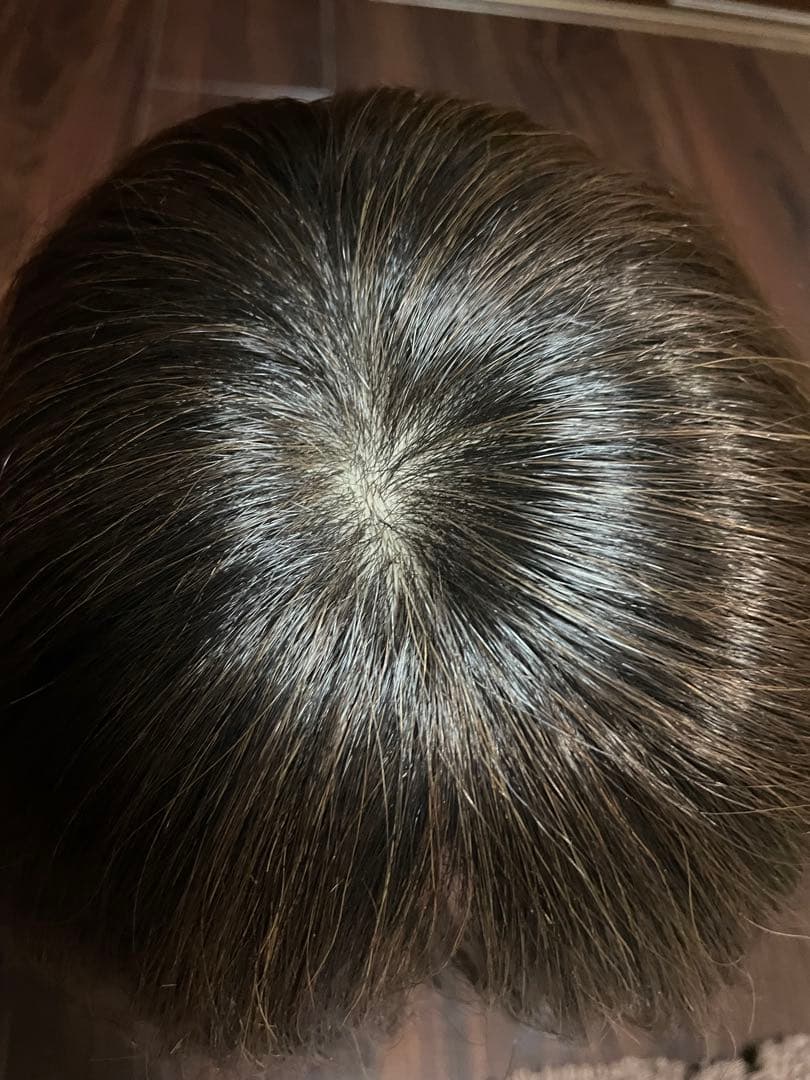 BEAUTY FIT 医療用 フルウィッグ ショート