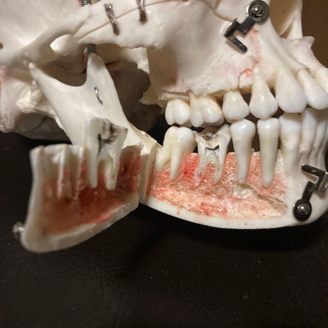 頭蓋骨　模型　解剖学