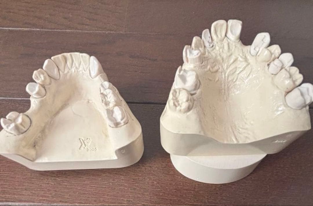 最終価格　歯科　支台歯形成　練習模型　セット