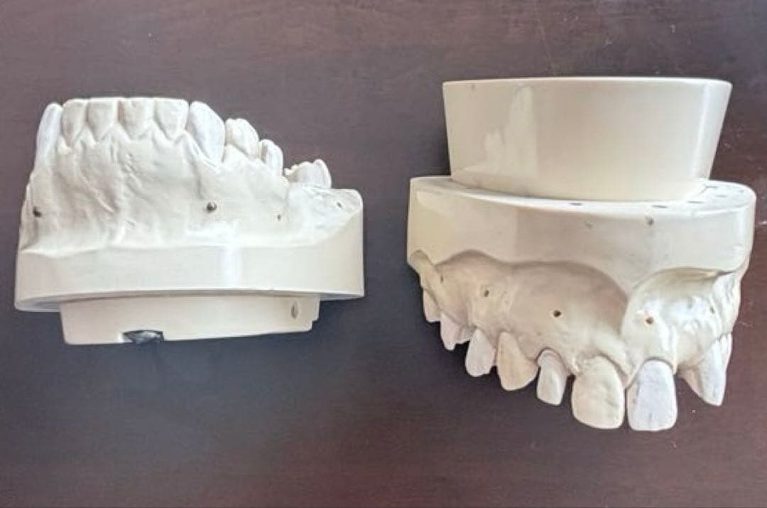 最終価格　歯科　支台歯形成　練習模型　セット