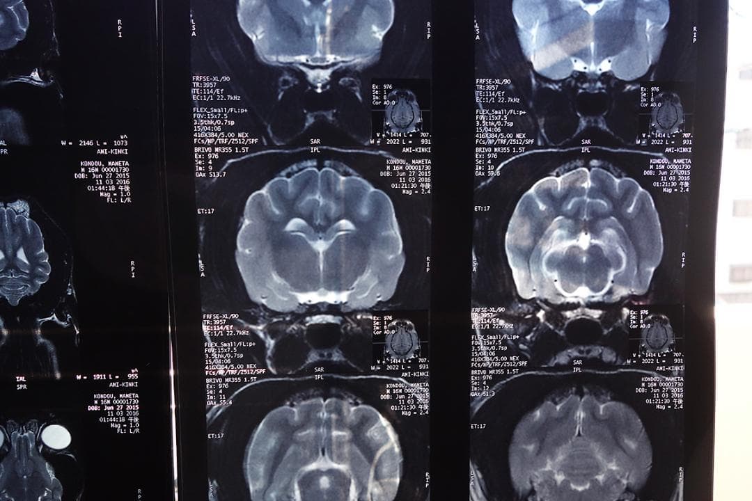 レントゲン 写真 3枚セット Z30