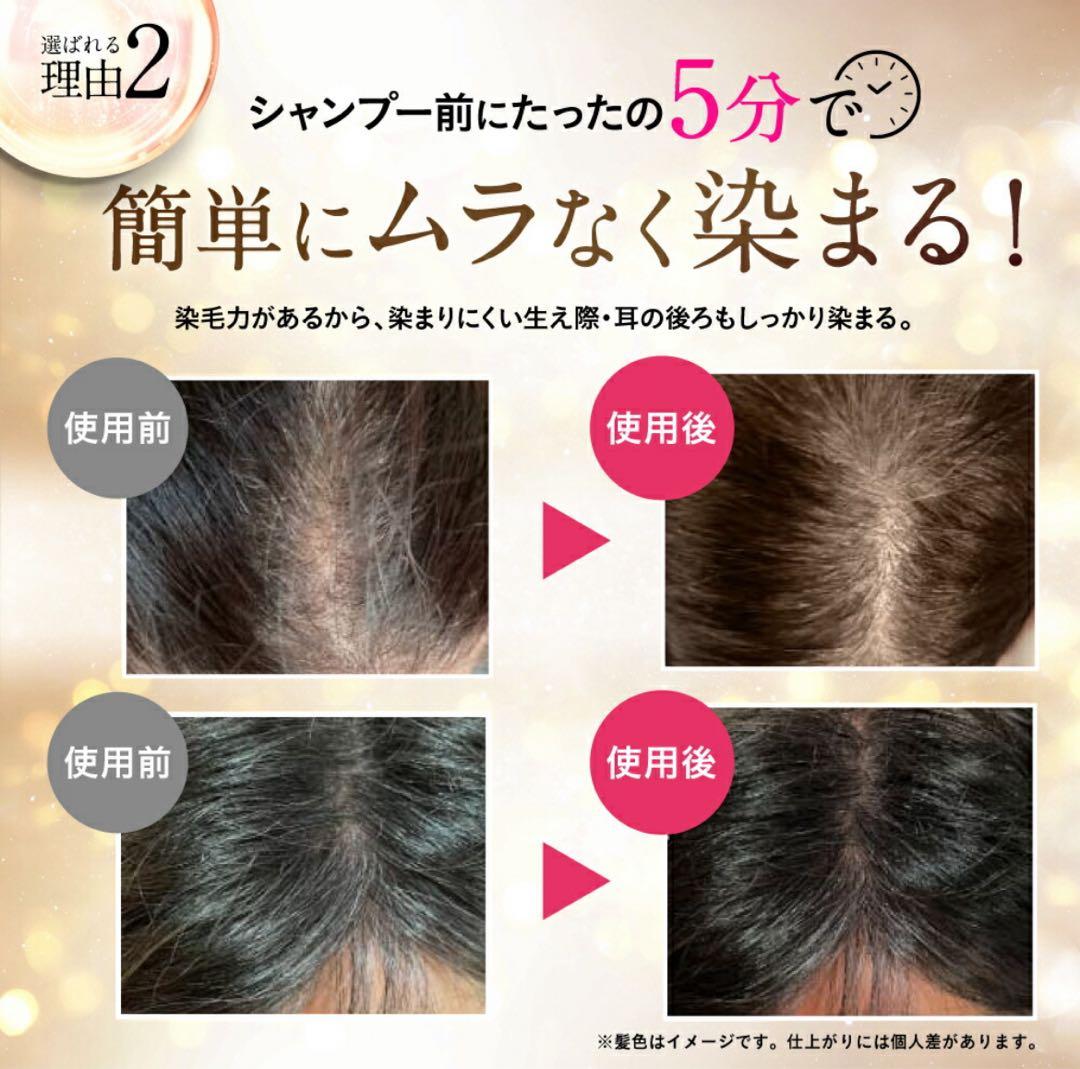 お得な３本セット楽天1位白髪染めビーリスカラーリング泡タイプ 部分染めb.ris