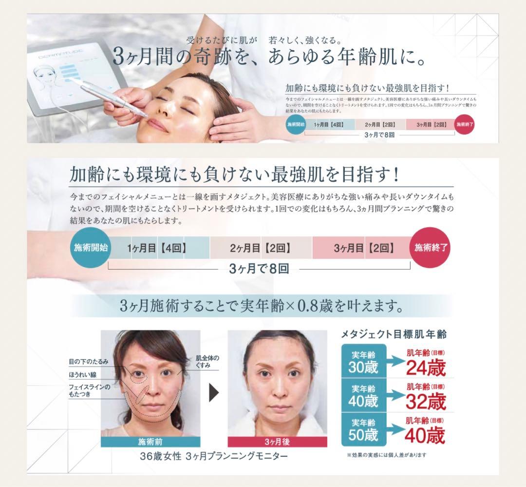 メタジェクト/しわシミ美容器具／エステ機器/美容パック/ダーマペン