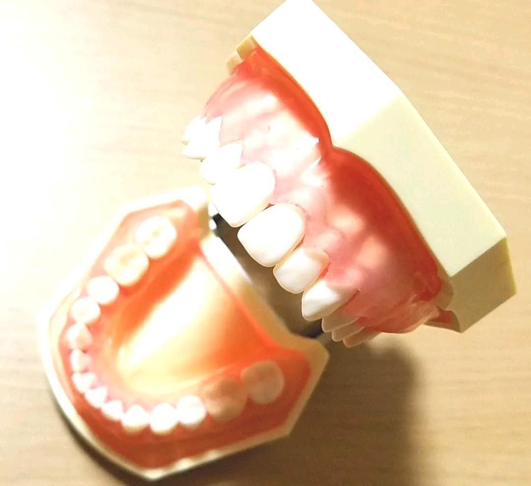 NISSIN DENTAL MODEL 顎模型 歯石セット セット売り
