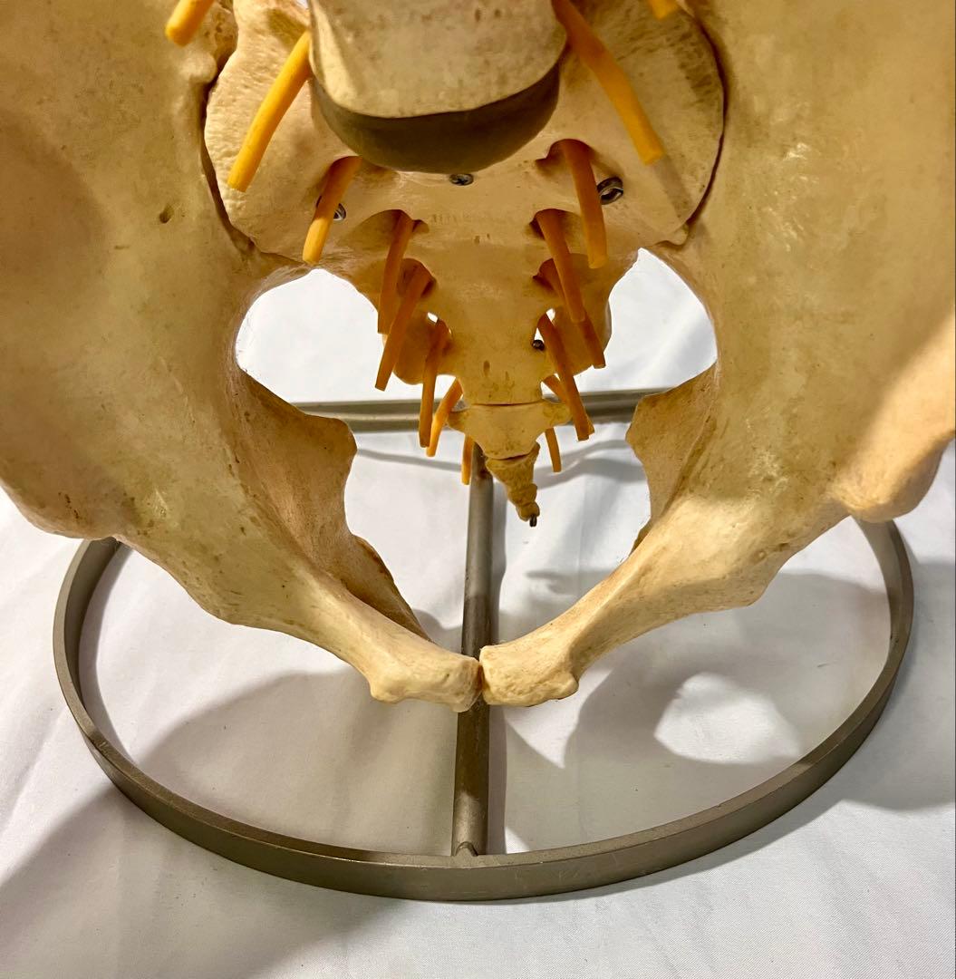 ① SOMSO ソムソ ドイツ製 脊髄 脊柱 骨格模型 モデル