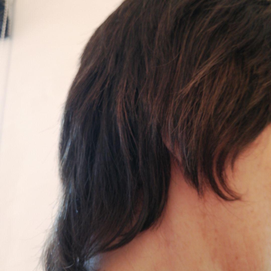 医療用スヴェンソンウィッグ人毛ミックス人工皮膚付きショートブラウン