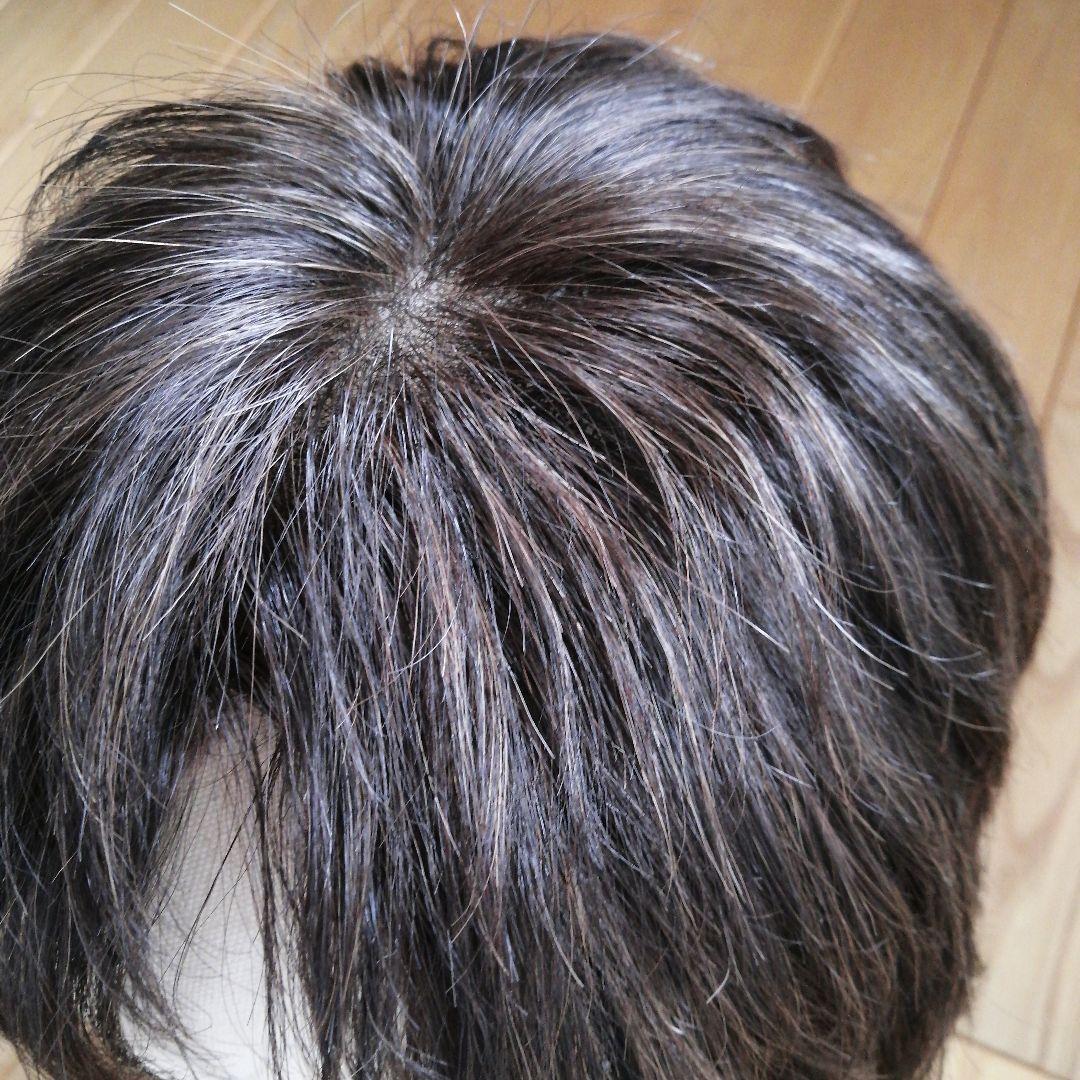 医療用スヴェンソンウィッグ人毛ミックス人工皮膚付きショートブラウン