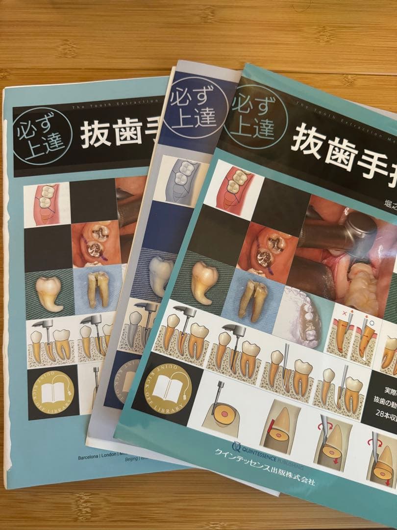 必ず上達 抜歯手技 増補新版 必ず上達 抜歯手技 増補新版