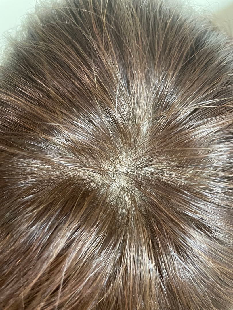 アデランス フォンテーヌ バランプレミアム 栗色 ハーフウィッグ 未使用に近い