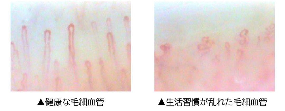 毛細血管スコープ 血管美人 SC-10-直営の公式通販サイト