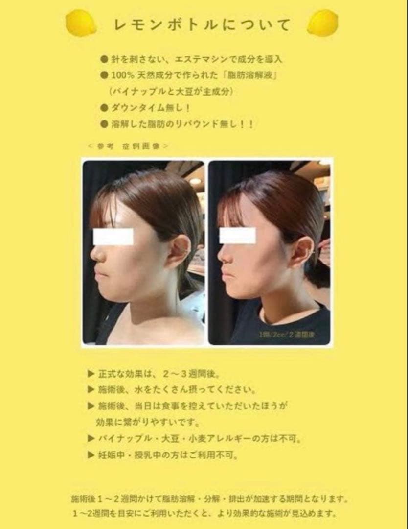 KWR　レモンボトル×3本