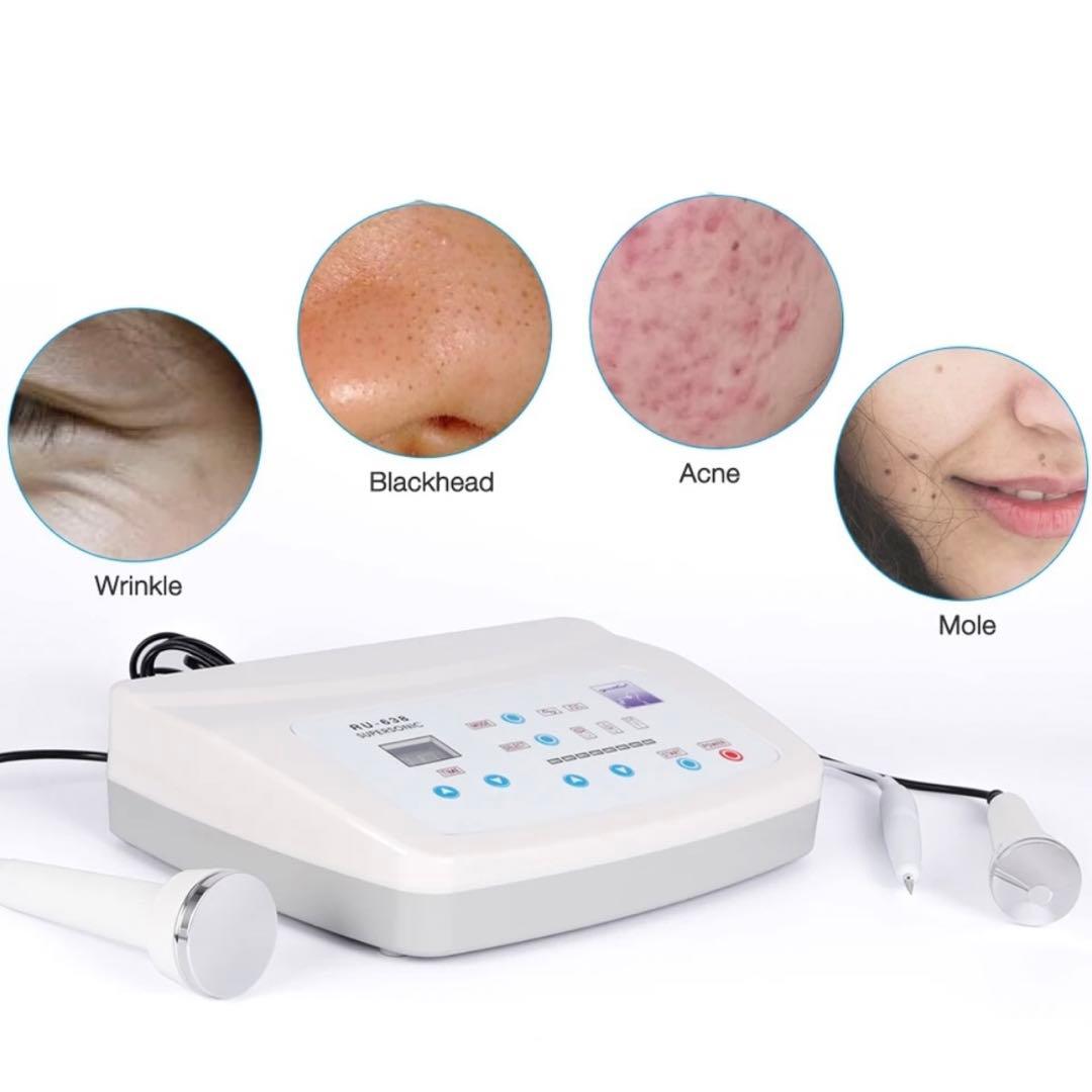 業務用 エステ版 超音波 シミ取り機械 シミ取りペン L108440004 - 美容